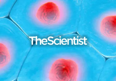 Exploring the Tumor Microenvironment with Spatial Biology